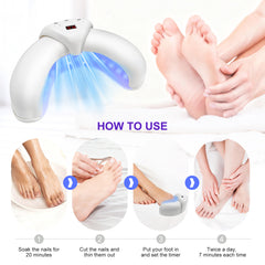 New Nail Fungus Laser Treatment for Toenails and Fingernails Home Use Reliable